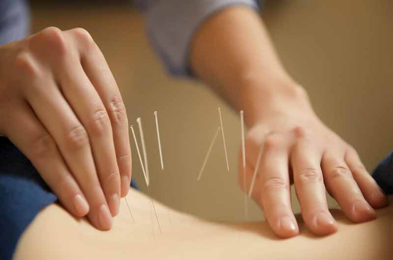 Đơn giản và tiện lợi là ưu điểm của phương pháp này Đơn giản và tiện lợi là ưu điểm của phương pháp này