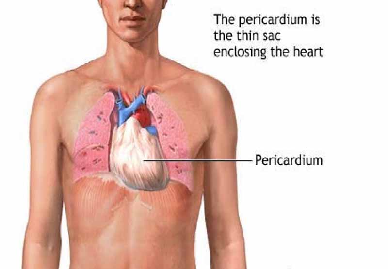 Nếu bị viêm màng ngoài tim bạn không nên dùng thuốc
