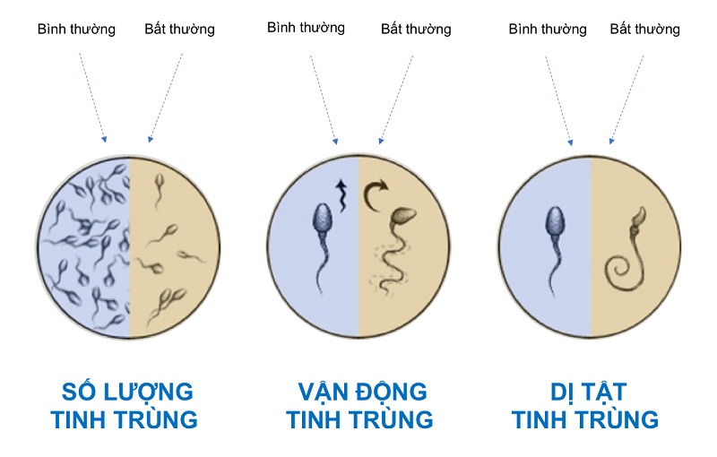 Tinh trùng yếu có dấu hiệu như thế nào? Tinh trùng yếu có dấu hiệu như thế nào?