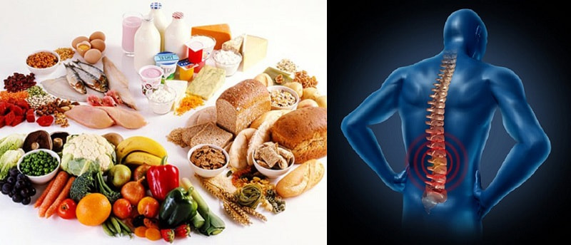 Bệnh gai cột sống nên ăn gì? Bệnh gai cột sống nên ăn gì?