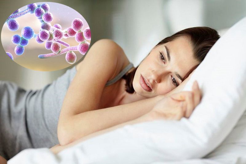 Dấu hiệu nhận biết nấm Candida ở nữ giới là gì?