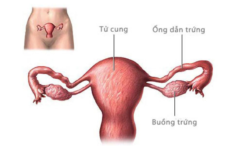 Dị tật ống dẫn trứng có thể dẫn tới mang thai ngoài tử cung