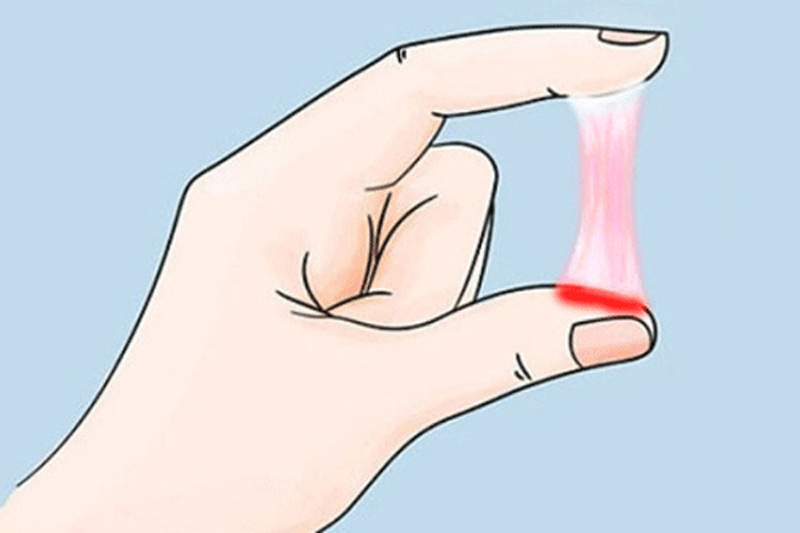 Khí hư màu hồng có thể là dấu hiệu cho thấy mẹ bị viêm âm đạo