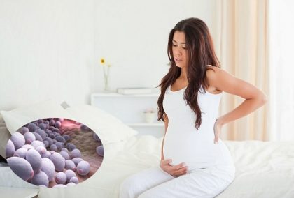 Nấm Candida khi mang thai