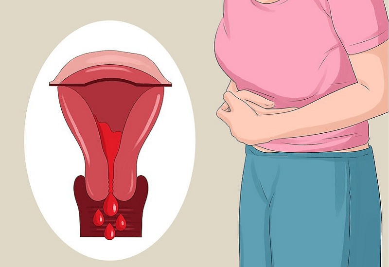 Quan hệ khi viêm phần phụ có thể gây ra những tổn thương tại cơ quan sinh dục nữ