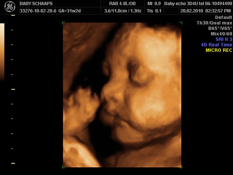 Siêu âm 4D sẽ giúp mẹ nhìn thấy thai nhi rõ nét hơn