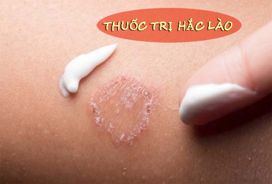 Thuốc trị hắc lào