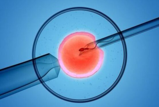 Tinh trùng được bơm vào trứng trong quá trình thụ tinh trong ống nghiệm