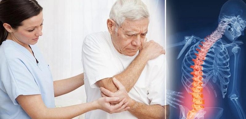 Chẩn đoán bệnh gai cột sống lưng Chẩn đoán bệnh gai cột sống lưng