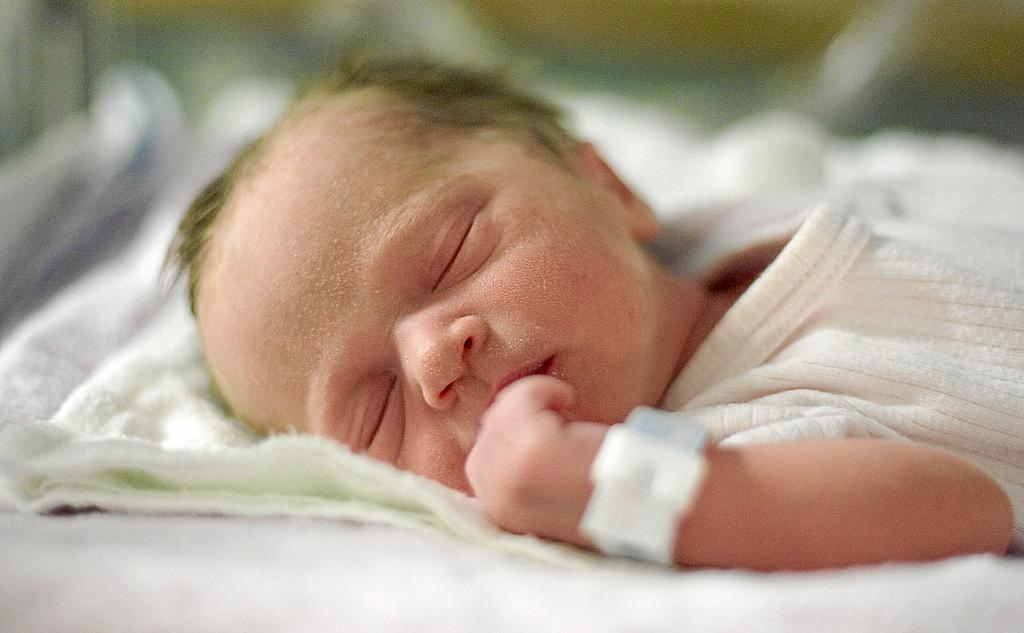 Trẻ sinh non ở 34 tuần có thể bị vàng da