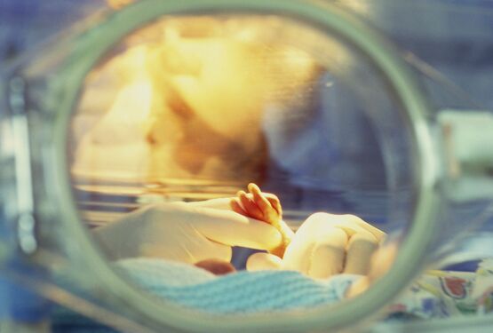 Tỷ lệ sống khi sinh non quá sớm là rất thấp