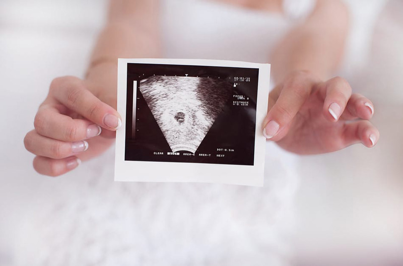 Nhiều mẹ mang thai 8 tuần nhưng siêu âm vẫn chưa thấy tim thai