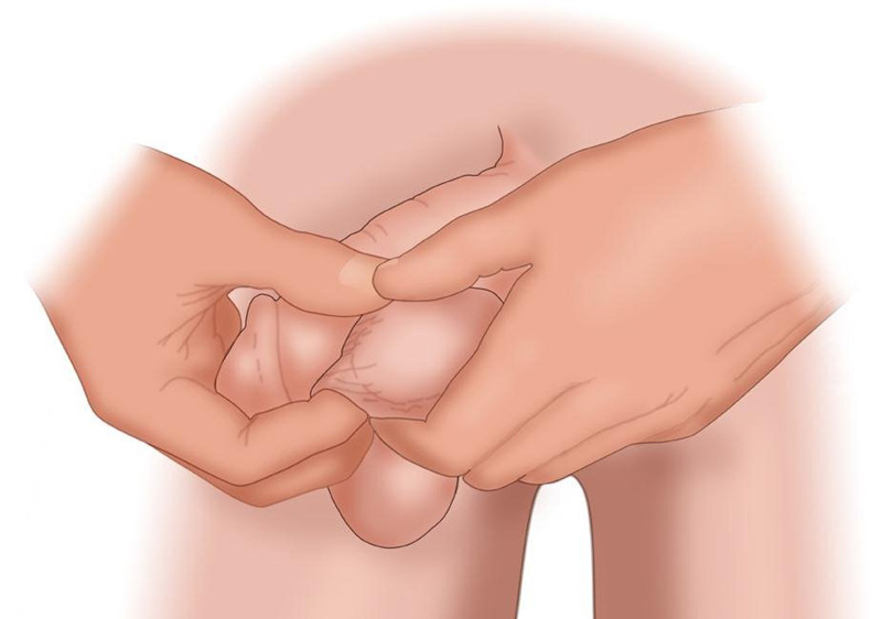 Nam giới nên kiểm tra "cậu nhỏ" để có thể phát hiện các dấu hiệu bất thường Nam giới nên kiểm tra "cậu nhỏ" để có thể phát hiện các dấu hiệu bất thường