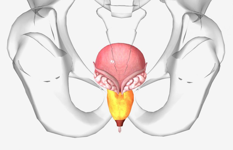 Viêm tuyến tiền liệt hoặc các bệnh viêm nhiễm khác là nguyên nhân hàng đầu gây xuất tinh ra máu kéo dài Viêm tuyến tiền liệt hoặc các bệnh viêm nhiễm khác là nguyên nhân hàng đầu gây xuất tinh ra máu kéo dài