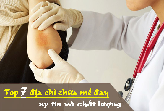 Địa chỉ chữa mề đay