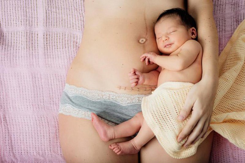 Cách sử dụng đai massage giảm mỡ bụng bụng sau sinh