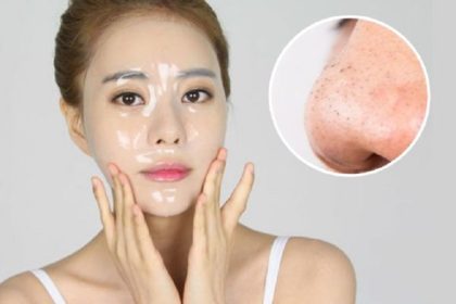 Kem thuốc trị mụn đầu đen
