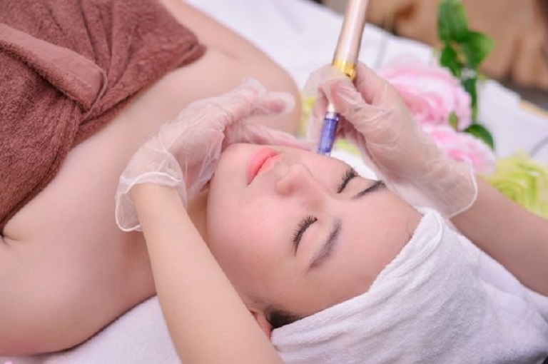 Phi kim vi điểm là công nghệ trị mụn hiện đại, mang lại hiệu quả cao